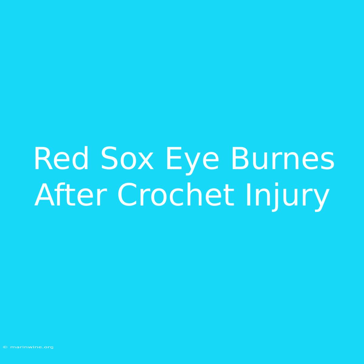 Red Sox Eye Burnes After Crochet Injury